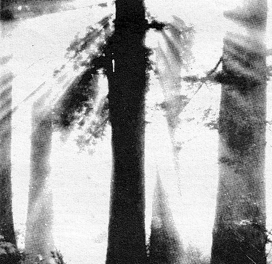 Tree_Sun_Web-sq